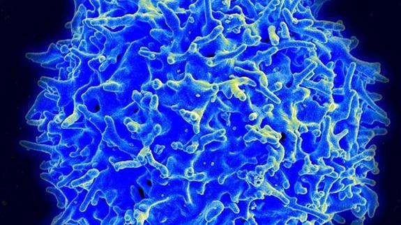 Los investigadores han analizado los linfocitos de pacientes con brotes de psicosis inicial 