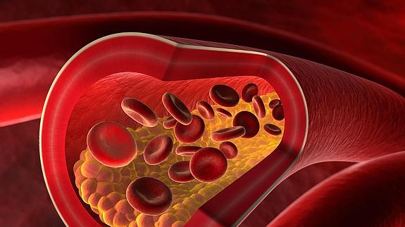 ¿Cuál es el tratamiento para las venas obstruidas?