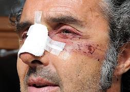 Carlos Gorairis, el manifestante herido en los incidentes del 14 N, antes de la rueda de prensa  | Foto: Guillermo Carrión/ AGM