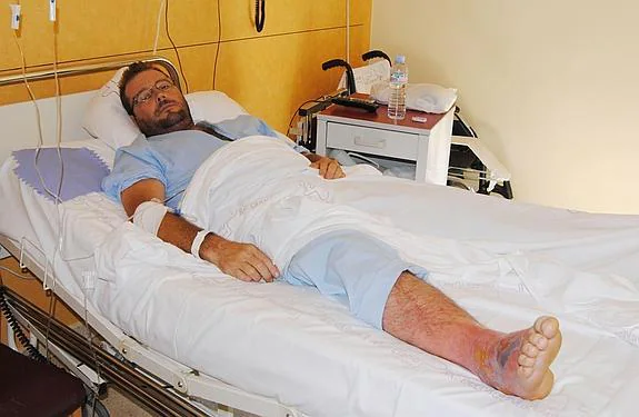 Manuel Pencas, en la habitación del Hospital del Noroeste en la que se recupera de la picadura de una araña parda (imagen izquierda), que le ha provocado una grave inflamación en el pie. 