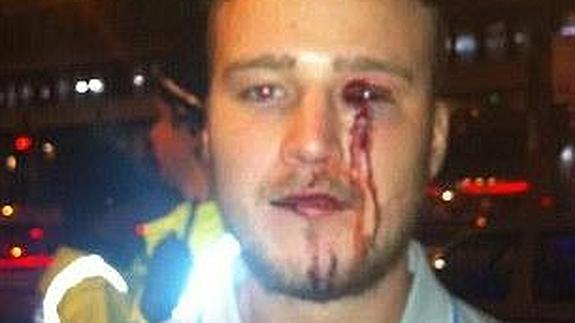 Una mujer clavó el tacón de su zapato a un chico y luego se burló en Facebook