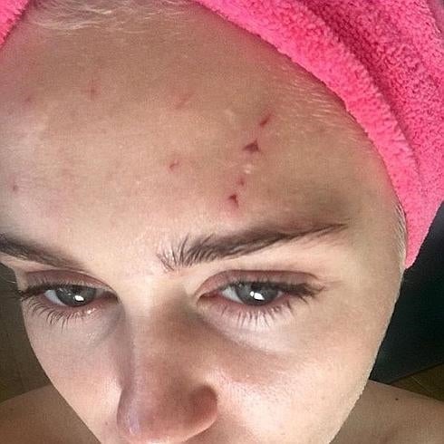 Arañazo de Miley Cyrus.