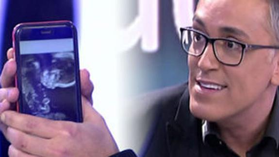 El colaborador mostró orgulloso las ecografías.