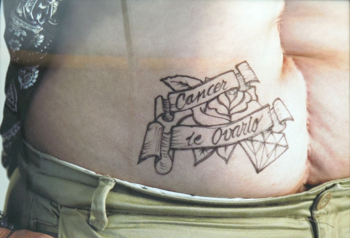 Historias de supervivencia