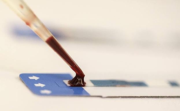 Un test para detectar VIH.