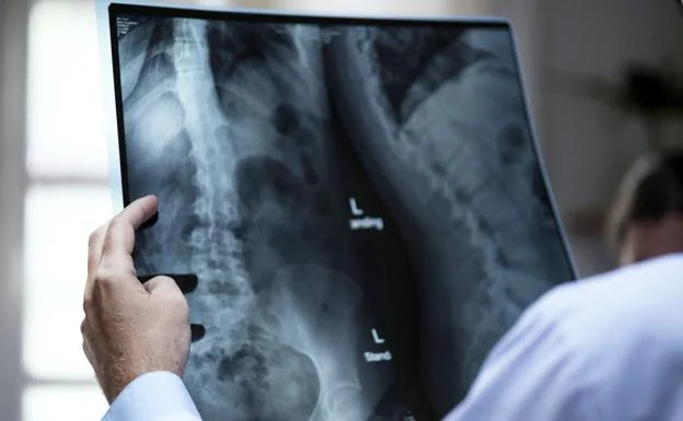 Un médico revisa una radiografía de un paciente.