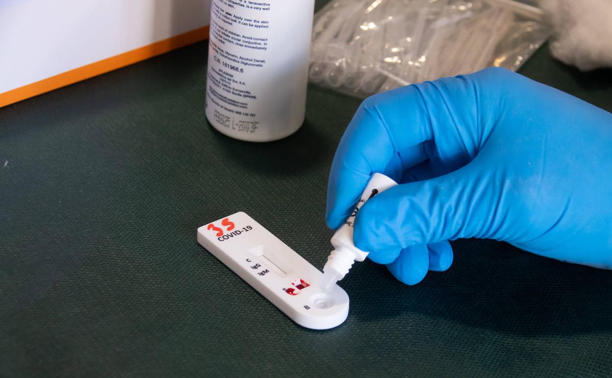 Una prueba de anticuerpos de detección del coronavirus.