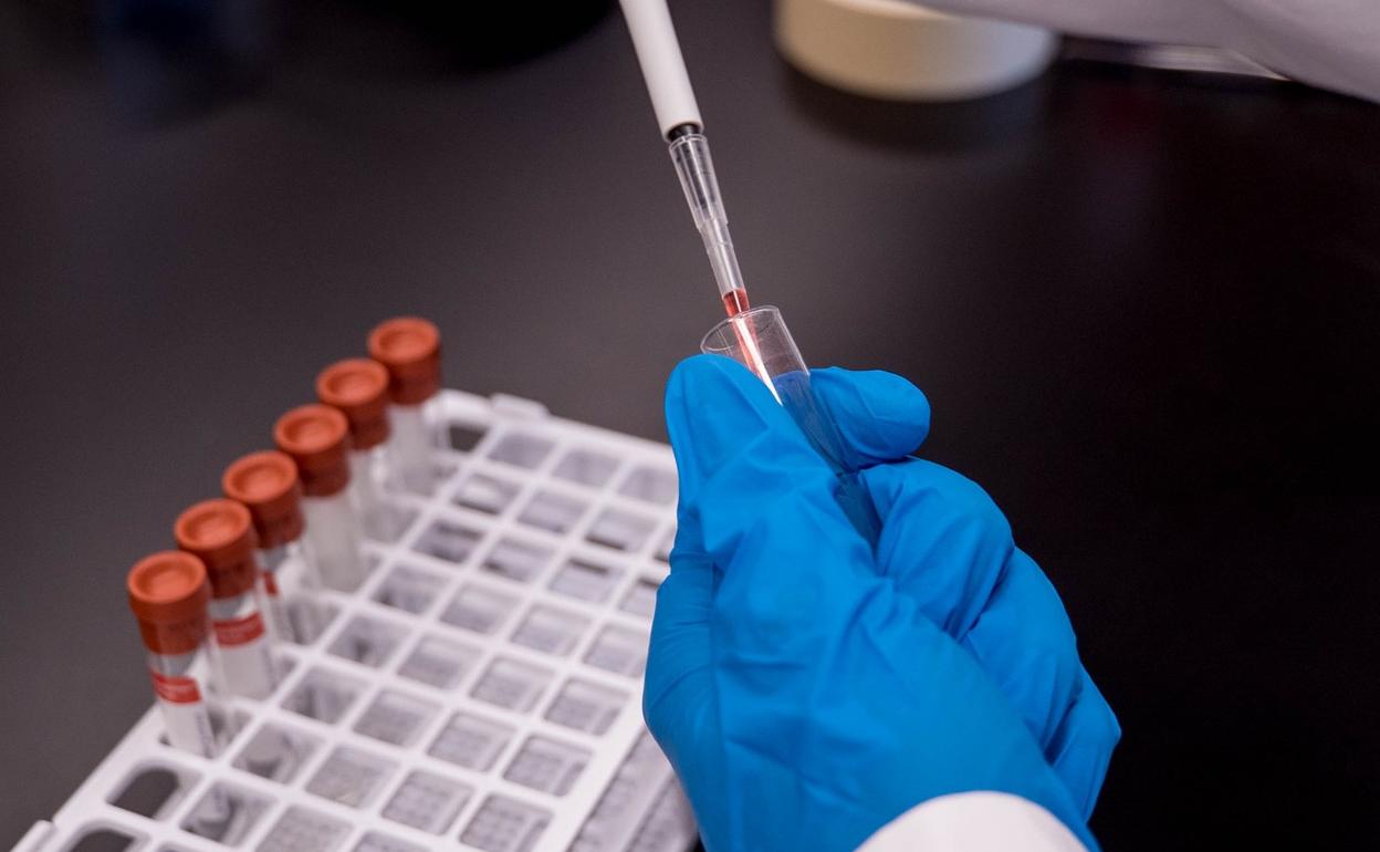 Imagen de pruebas PCR para detectar coronavirus COVID-19.