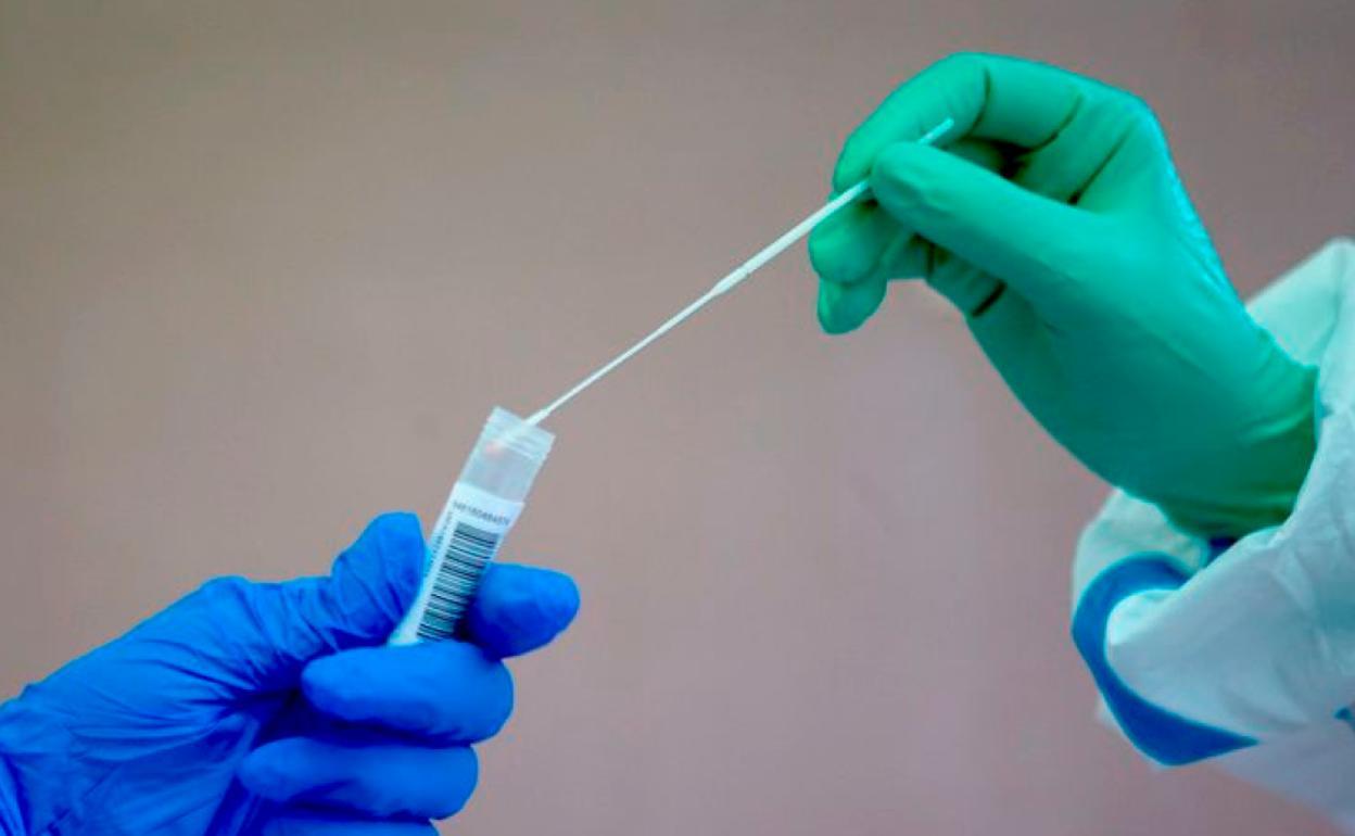 Imagen de una prueba PCR.