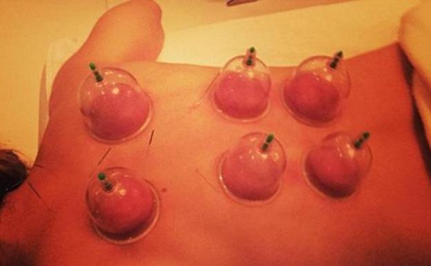 Primeras sesiones de cupping de Madonna. 