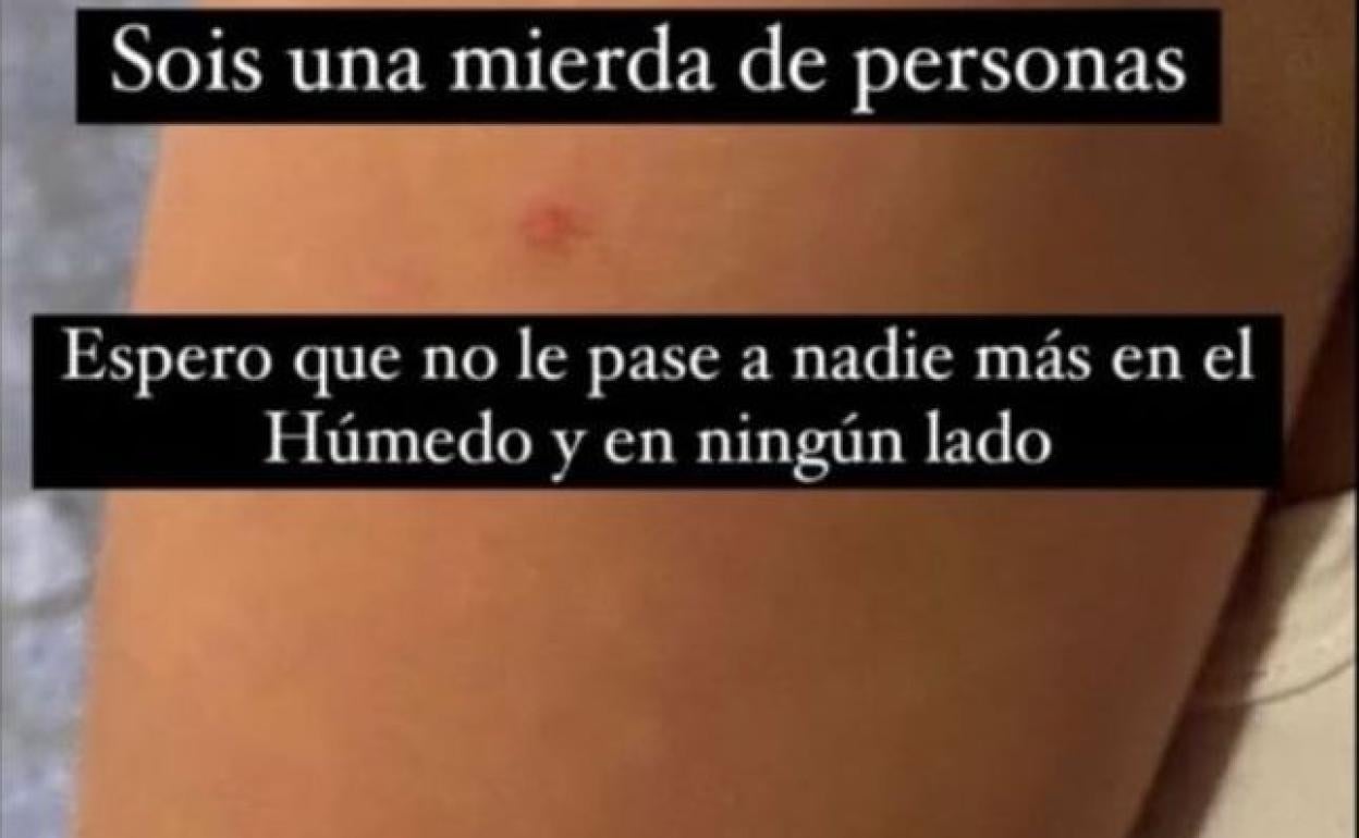 Imagen parcial del mensaje de alerta y del pinchazo en el brazo de una mujer. 