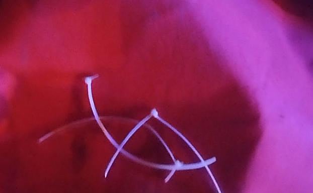 Bridas de la bandera que aparecieron cortadas.