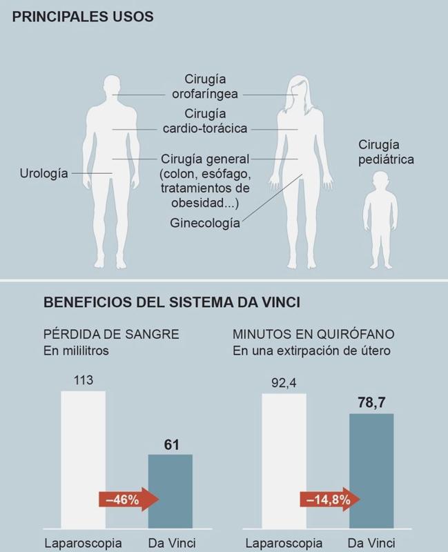 Beneficios del sistema Da Vinci.