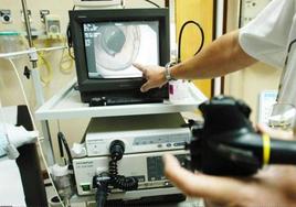Un médico señala una parte del colon en una pantalla tras realizar una colonoscopia.