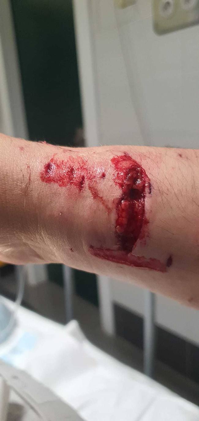 Dos pitbull atacan a un hombre en Villaobispo