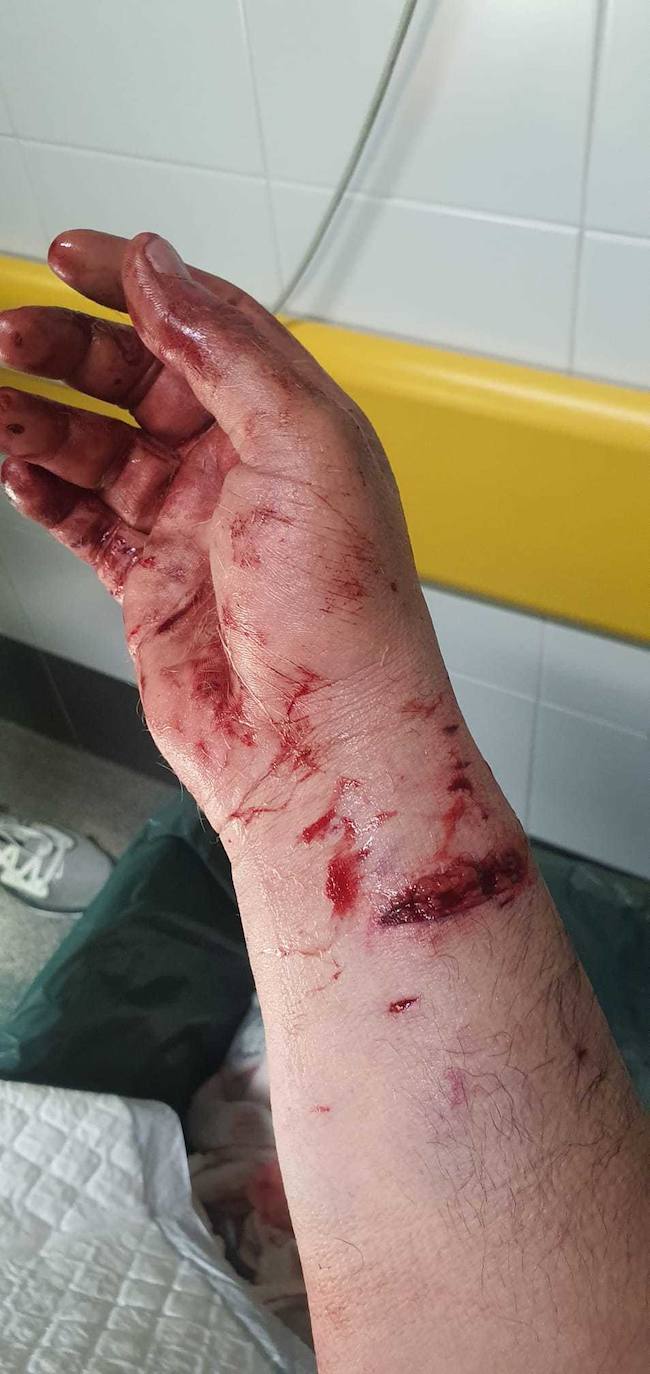 Dos pitbull atacan a un hombre en Villaobispo