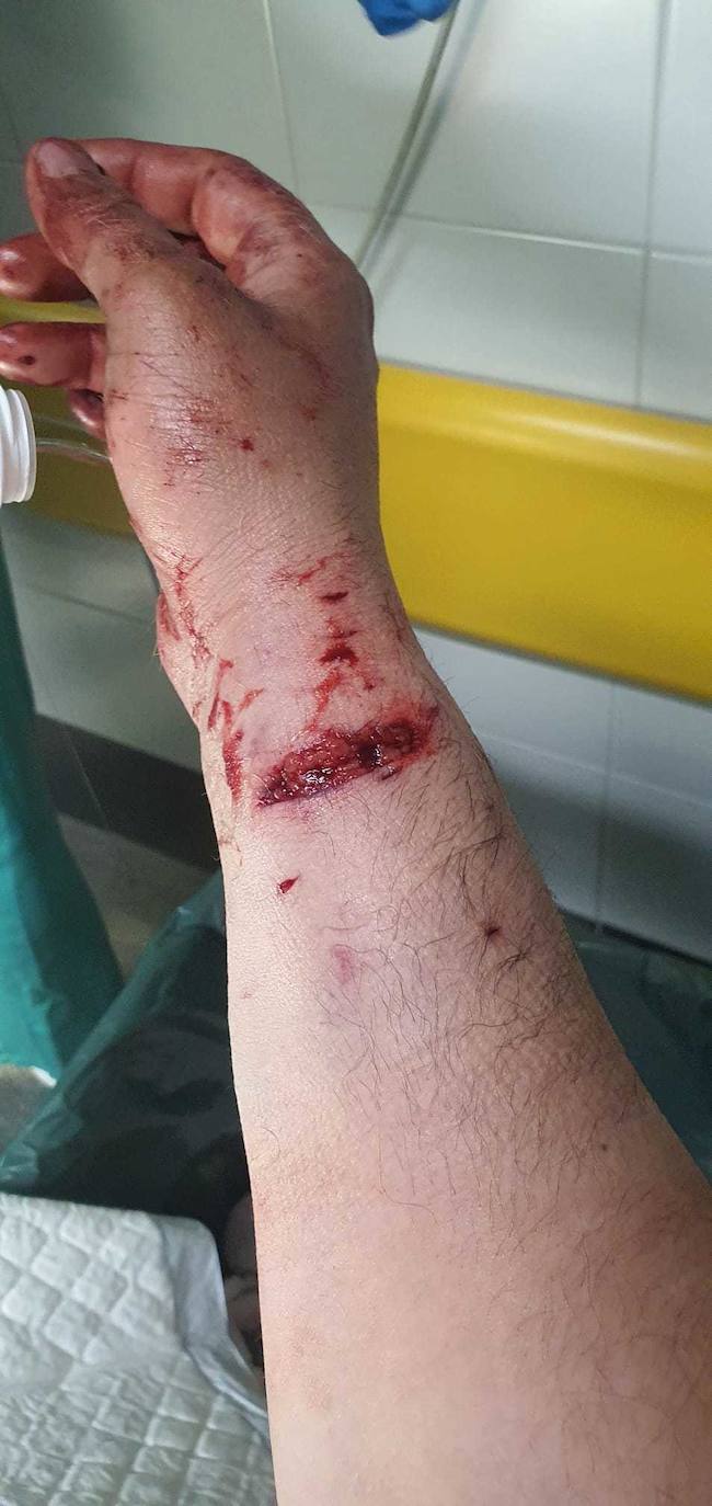 Dos pitbull atacan a un hombre en Villaobispo