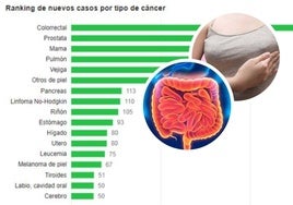 Tipos de cáncer más frecuentes en León.