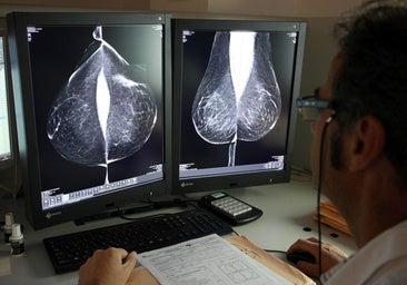 Sanidad incorporará la inteligencia artificial a la lectura de mamografías y radiografía torácica