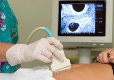 Castilla y León trabaja ya en su registro de objetores de conciencia ante el aborto