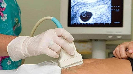 Castilla y León permitirá a los sanitarios objetar por supuestos de aborto en su registro de objeción de conciencia