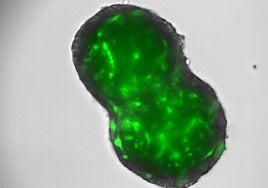 Tipo de cáncer al que nos referimos.