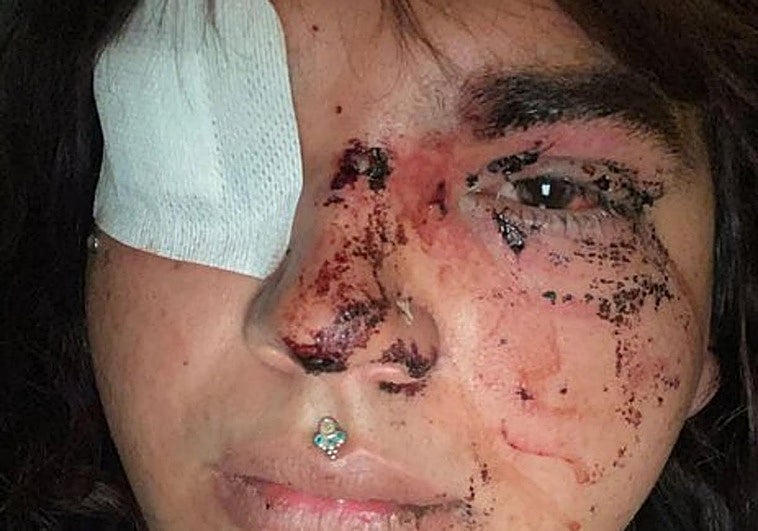 Una mujer trans denuncia una brutal agresión por ocho personas en La Bañeza