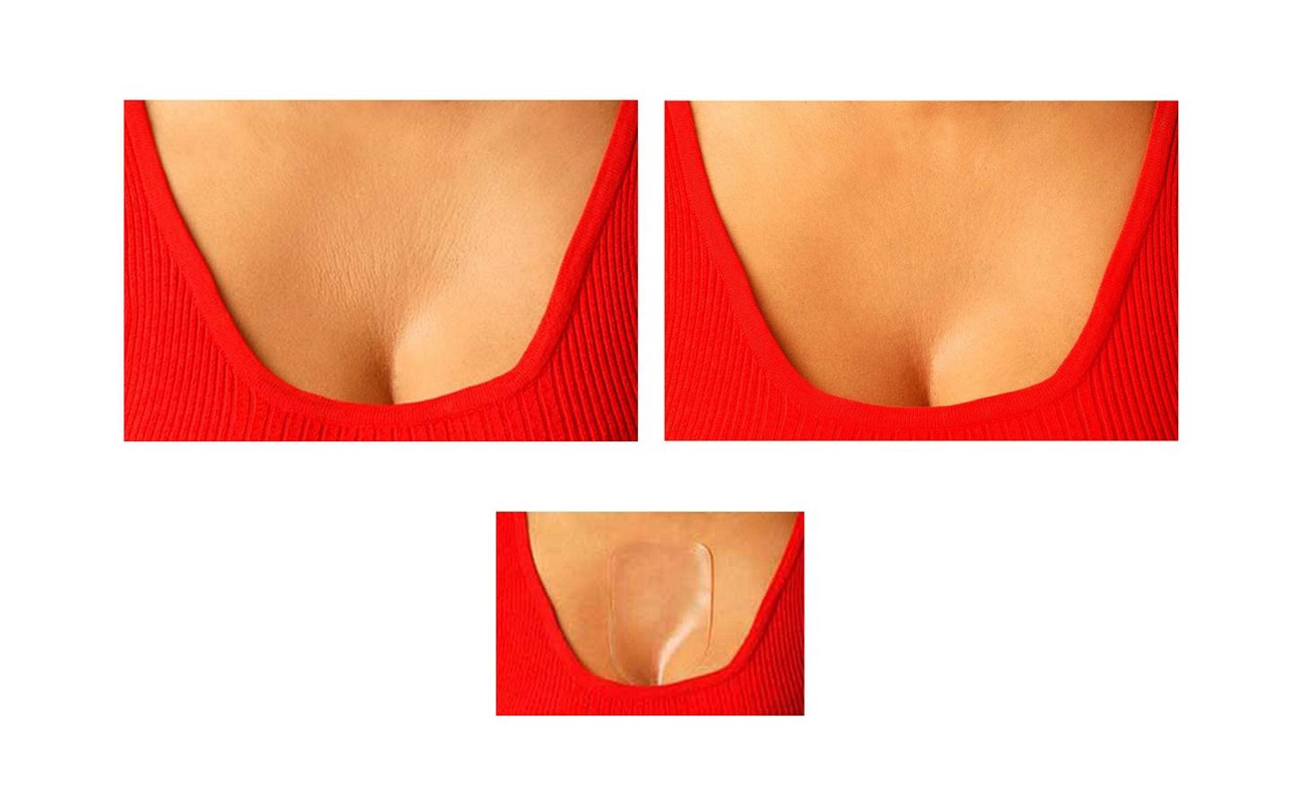 Los parches de silicona que reducen las "líneas de expresión" al pegarse a la piel e impedir que en posición lateral se produzcan los pliegues. Al pasar con ellos la noche se irán borrando las arrugas en un par de semanas. (37,50 €)