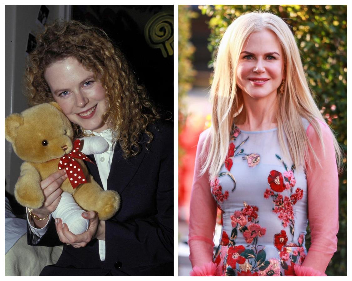 Nicole Kidman ya ha reconocido arrepentirse de las operaciones y tratamientos estéticos a los que se ha sometido. En 1990 la actriz presumía de rizos pelirrojos y rezumaba frescura. 27 años después, aunque muy cambiado, la australiano sigue conservando su belleza, pero cuesta reconocerla.