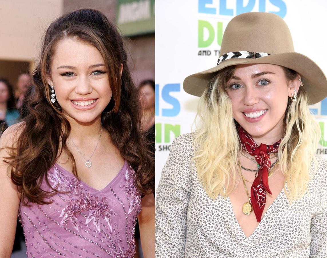 La polémica cantante es otra de las celebrities que decidió hacerse una rinoplastia.