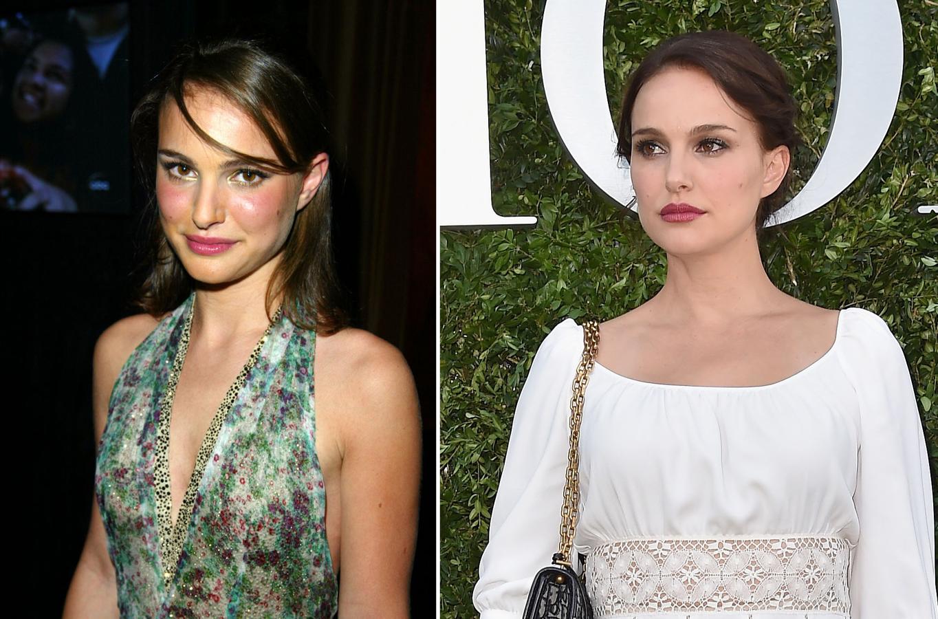 La actriz Natalie Portman, de ascendecia israelí, también ha pasado por el quirófano para retocarse la nariz.