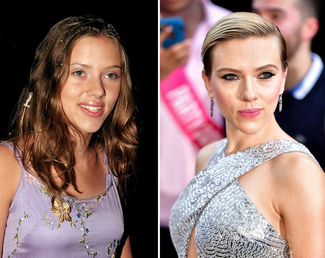 La actriz Scarlett Johansson es otra de las famosas que se ha sometido a una rinoplastia.