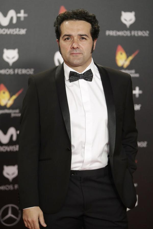 Alfonso Sánchez sufría alopecia y le puso solución con un injerto capilar,