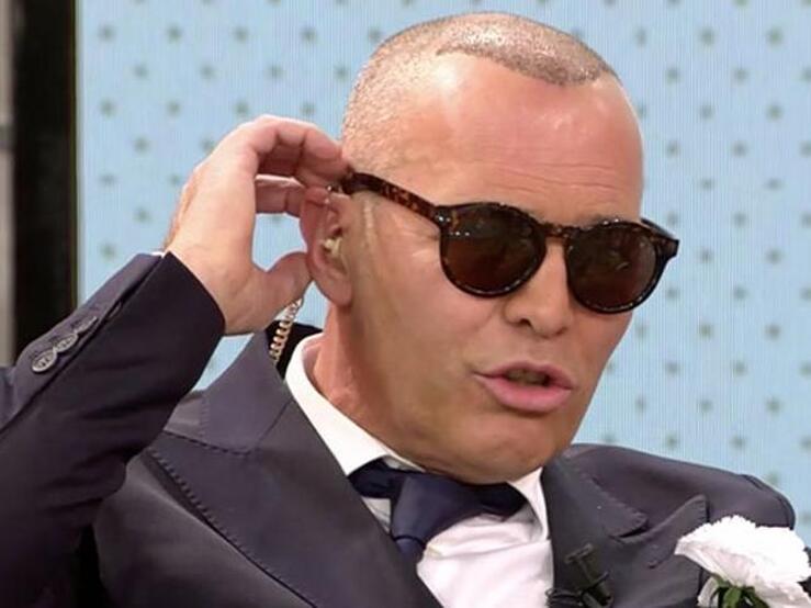 Fotos: Famosos que se han hecho un injerto de pelo