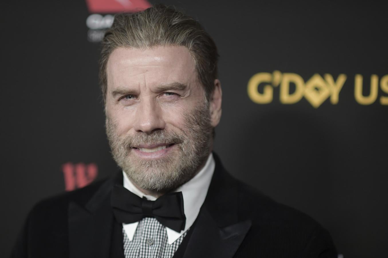 John Travolta soprendió con una melena muy poblado de un momento a otro. Los injertos capiilares acabaron con su alopecia.