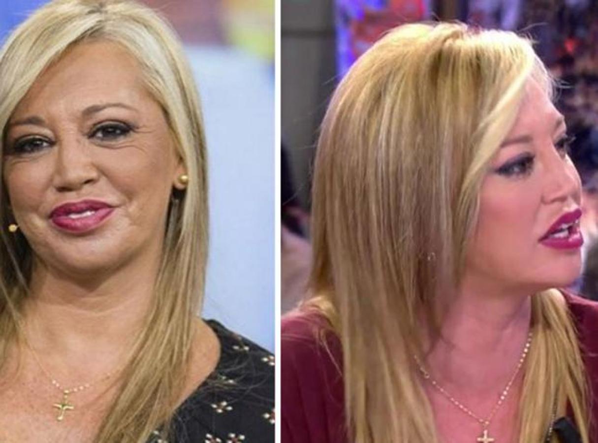 Belén Esteban acaba de sumar un retoque más a su rostro.