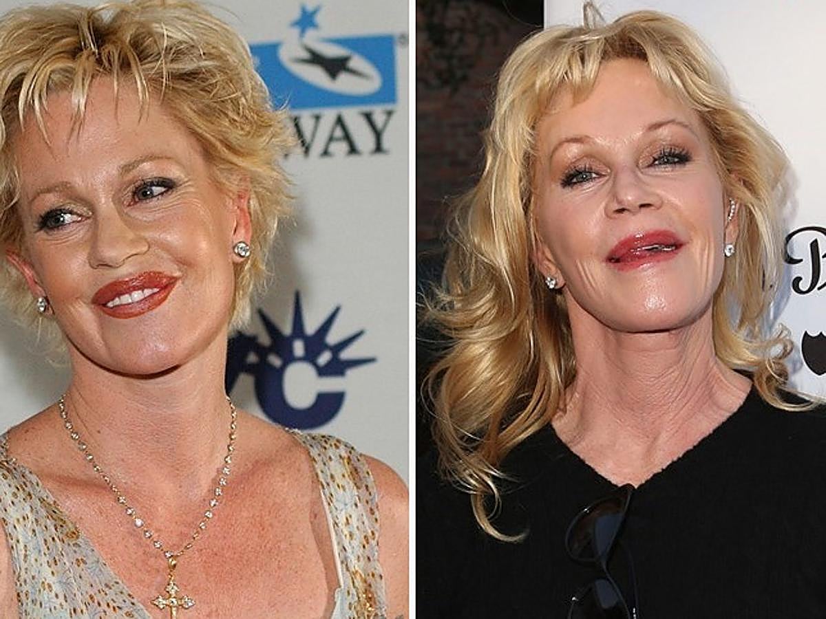 Melanie Griffith ha declarado que sus operaciones de estética en la cara no fueron bien hechas.