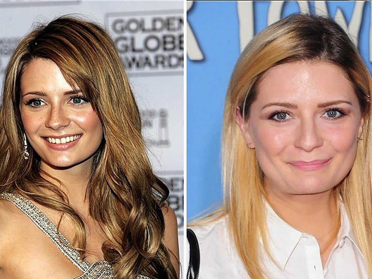 Con las operaciones de estética, la actriz Mischa Barton perdió su dulce expresión.