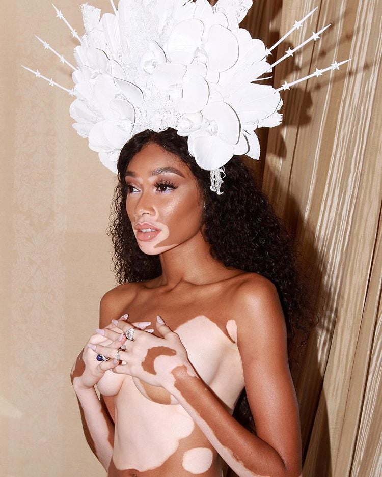 El desnudo de  Winnie Harlow . Impresionante bellezón el de la modelo, posando vestida únicamente con el tocado que llegó a la Gala del Met.