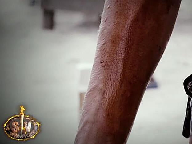 Estas son las secuelas que La noria dejó en la piel de Sofía Suescun.