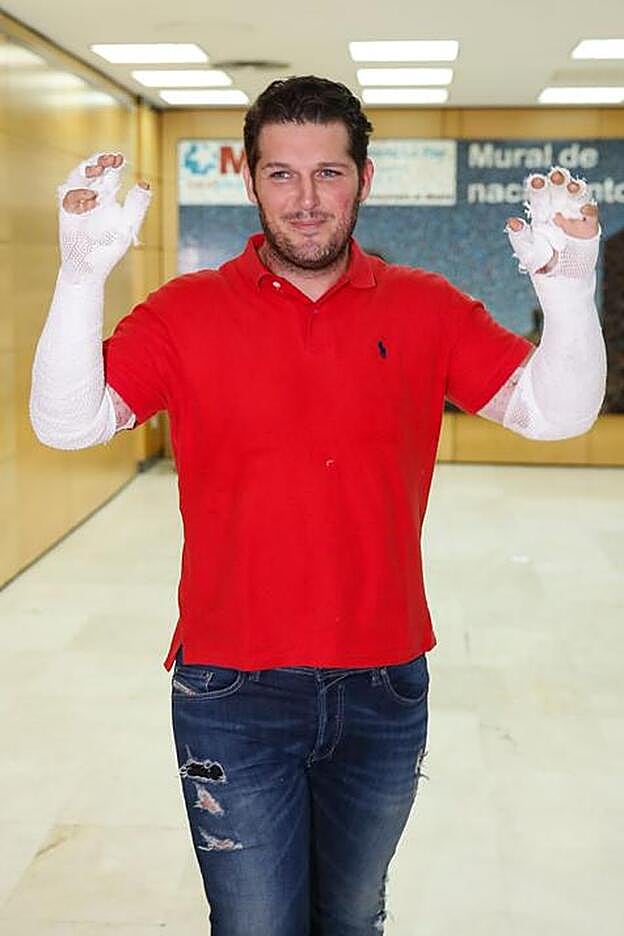 Manu Tenorio muestra sus brazos vendados a su salida del hospital.