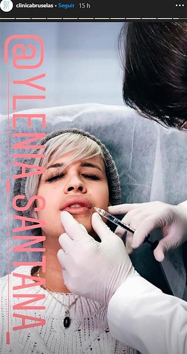 Ylenia Padilla inyectándose ácido hialurónico.