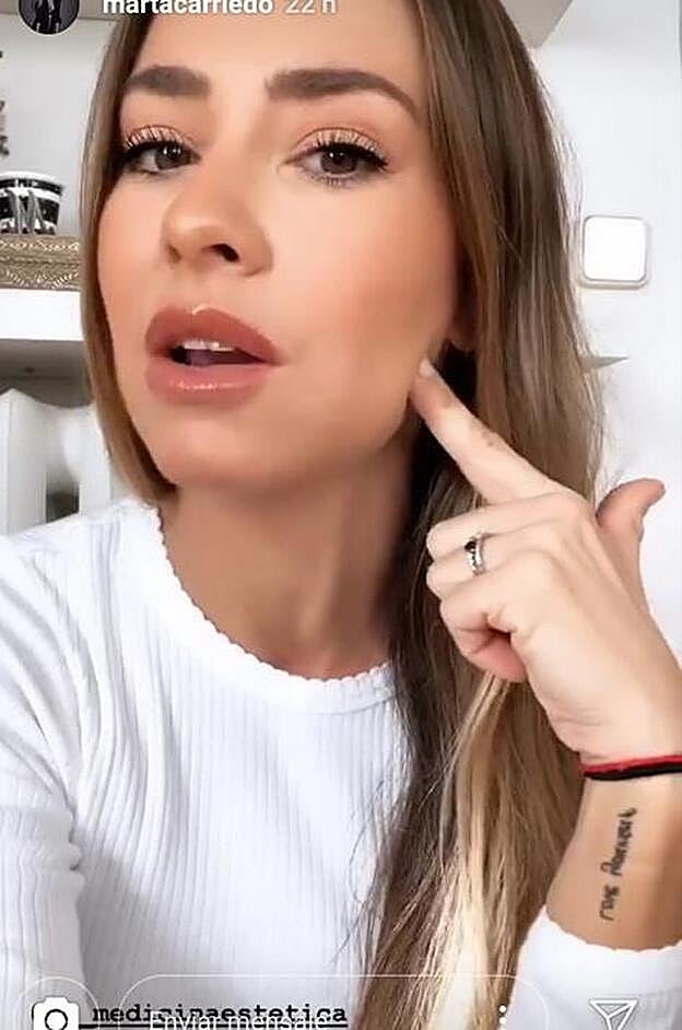 La 'influencer' también ha mostrado los resultados de su tratamiento de vitaminas en el rostro.