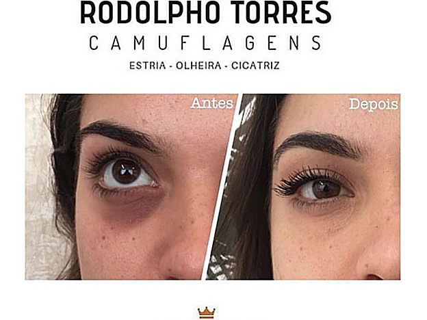 Otra de las pacientes del tatuador brasileño Rodolpho Torres.