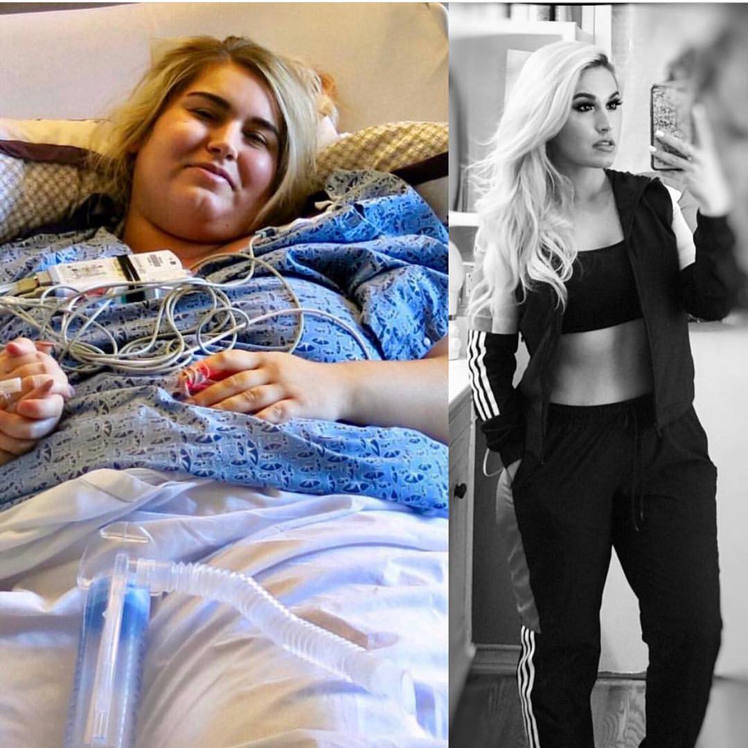 Cambria Harris pesaba más de 142 kilos cuando decidió hacerse una gastrectomía. Actualmente está en algo más de 75. En su cuenta de Instagram, además de los hashtags que atestiguan el progreso de una persona que se ha sometido a una intervención de este tipo, se pueden leer mensajes positivos como el que acompaña a esta foto: “Posiciónate y toma el lugar en el mundo para el que estabas destinada”.