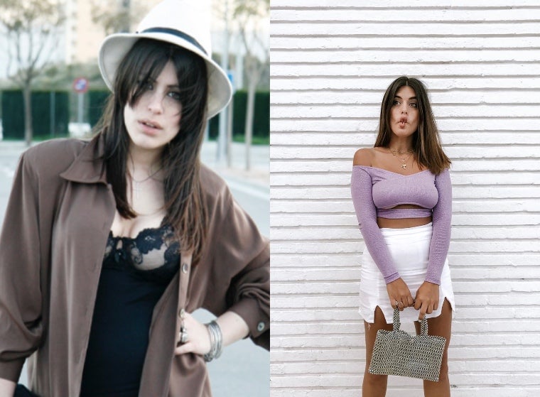 A diferencia de la mayoría de mujeres que se operan el pecho para aumentarlo, Aida Domenech pasó por quirófano hace más de cinco años para disminuirlo (ahora usa una 90B). No se sentía cómoda con él y ha asegurado en más de una ocasión que le provocaba dolor de espalda. Compartió en YouTube un vídeo dónde explica todo el proceso y sus inseguridades a la hora de dar este paso tan importante para ella.