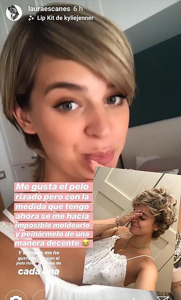 Laura Escanes ha mostrado el resultado antes y el después del tratamiento en sus stories.