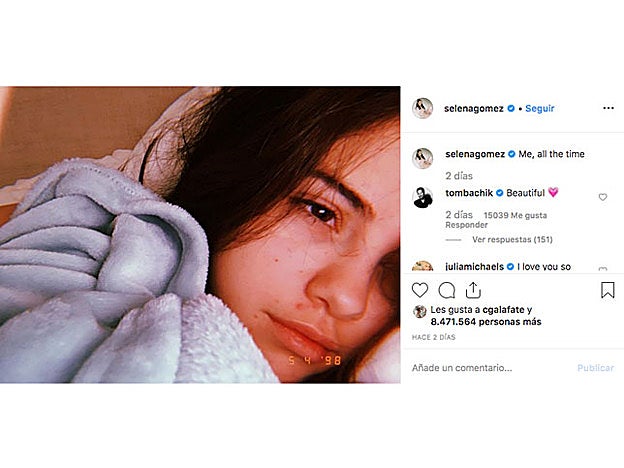 En este selfie sin maquillaje Selena Gomez no muestra su mejor cara...