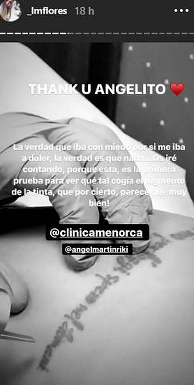 Laura Matamoros decide eliminar uno de sus tatuajes.