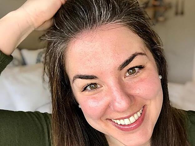 Las canas en los mechones delanteros, como Pícara.